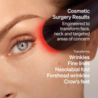 The LYMA Laser